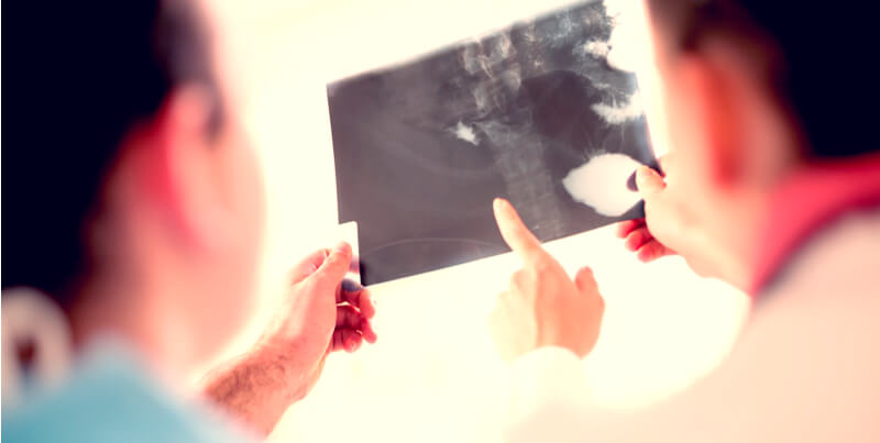 incapacidad permanente por enfermedad congénita incapacidad permanente por enfermedad congénita