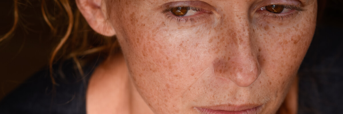 reconoce-incapacidad-absoluta-grave-cuadro-fibromialgico-afectacion-cognitiva