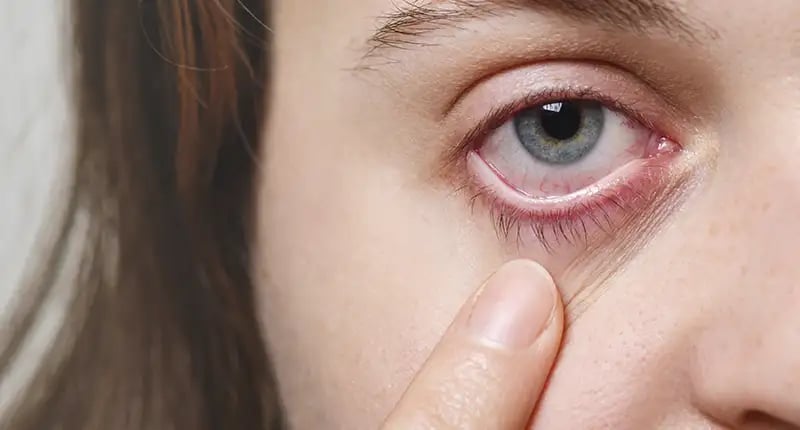 35000-euros-de-indemnizacion-por-incapacidad-parcial-a-una-contable-con-glaucoma