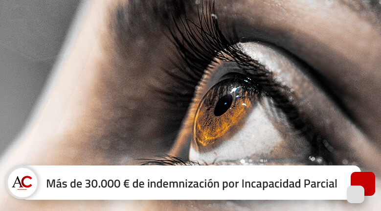 Más de 30.000 € de indemnización por Incapacidad Parcial