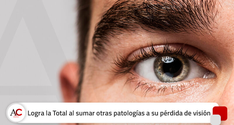 Por pérdida de visión solo le daban la Parcial, pero logra la Total por sumar otras patologías