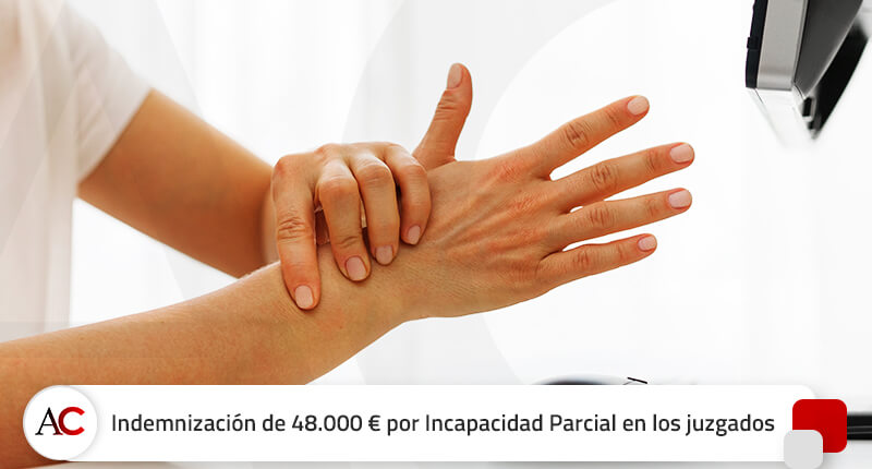 Indemnización de 48.000 € por Incapacidad Parcial, algo muy poco habitual en los juzgados